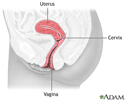 Cervical dysplasia - series
