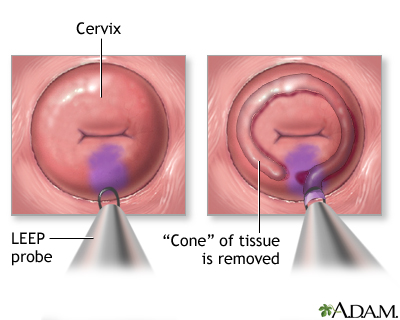 Procedure, part 2 Procedure, part 2