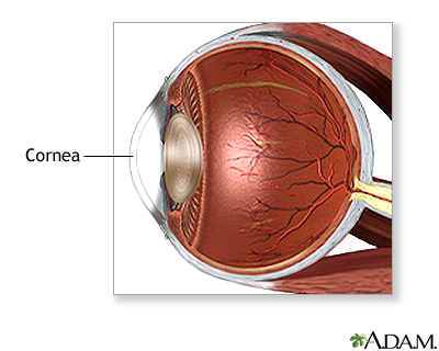 Corneal transplant - normal anatomy Corneal transplant - normal anatomy