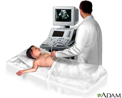 Abdominal ultrasound Abdominal ultrasound