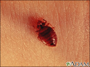 Bedbug - close-up Bedbug - close-up