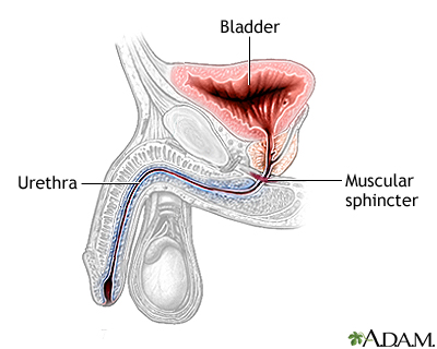 Inflatable artificial sphincter - series - Normal anatomy Inflatable artificial sphincter - series - Normal anatomy