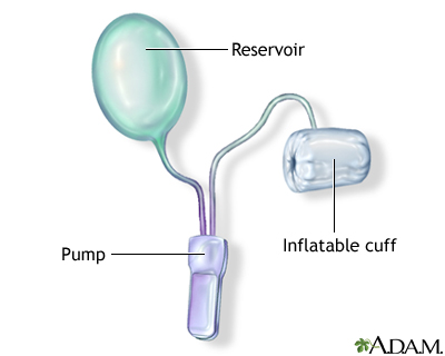 Procedure, part 1 Procedure, part 1