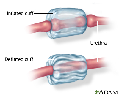 Procedure, part 3 Procedure, part 3