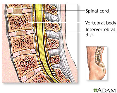 Lumbar spinal surgery - Series