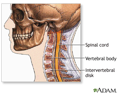 Spinal surgery - cervical - series Spinal surgery - cervical - series