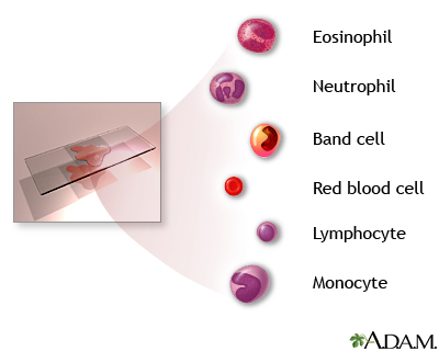 Complete blood count - series - Indication Complete blood count - series - Indication