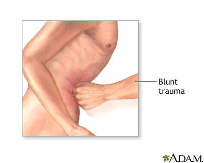 Diagnostic peritoneal lavage - series