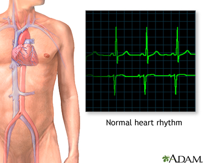 Normal heart rhythm Normal heart rhythm