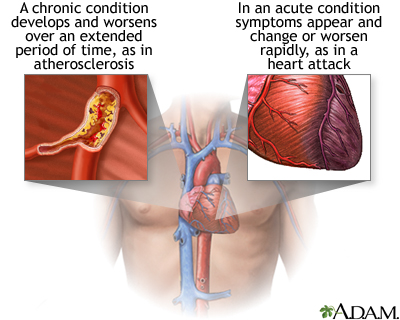 Acute vs. chronic conditions Acute vs. chronic conditions