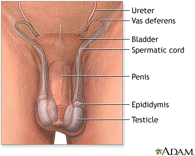 Testicular torsion repair - series Testicular torsion repair - series