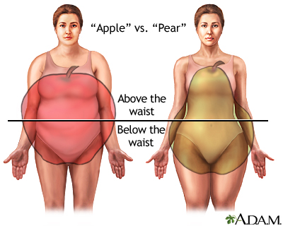 Different types of weight gain Different types of weight gain