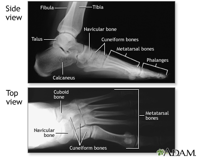 Normal foot X-ray Normal foot X-ray