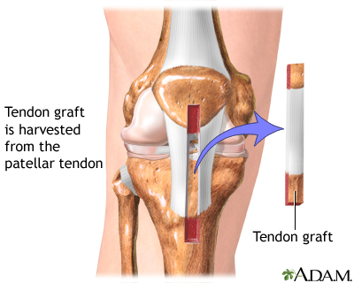 Procedure, part 1 Procedure, part 1