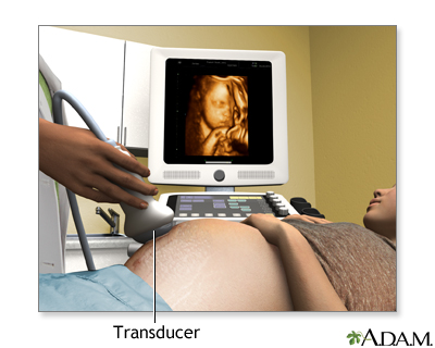 3D ultrasound 3D ultrasound
