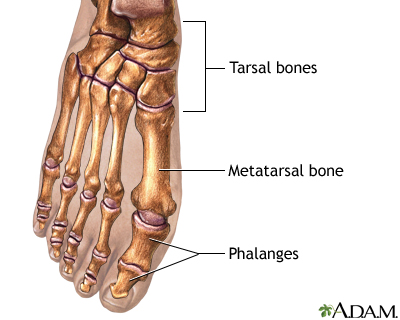 Bunion removal - Series Bunion removal - Series