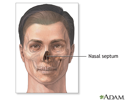 Septoplasty - series - Septal anatomy Septoplasty - series - Septal anatomy