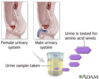Aminoaciduria urine test