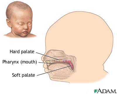Infant hard and soft palates Infant hard and soft palates