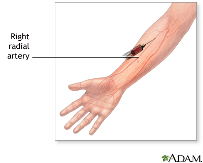 Blood gases test Blood gases test