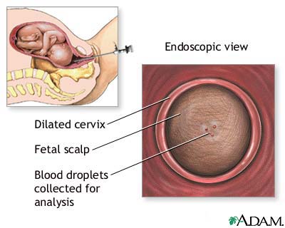 Fetal blood testing Fetal blood testing