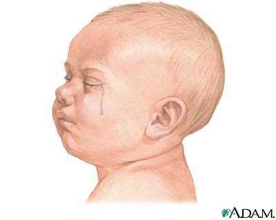 Crying - excessive (0 to 6 months) Crying - excessive (0 to 6 months)