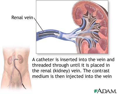 Renal veins Renal veins