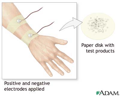 Sweat test Sweat test