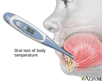 Temperature measurement Temperature measurement