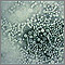 Hepatitis B virus Hepatitis B virus