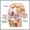 Knee arthroscopy - series - Normal anatomy Knee arthroscopy - series - Normal anatomy