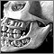 Teeth, adult - in the skull Teeth, adult - in the skull