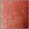 Tinea versicolor - close-up Tinea versicolor - close-up