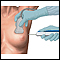 Core needle biopsy of the breast Core needle biopsy of the breast