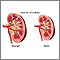 Changes in kidney with age Changes in kidney with age