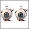 Before and after corneal surgery Before and after corneal surgery