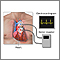 Holter heart monitor Holter heart monitor