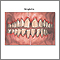 Gingivitis Gingivitis