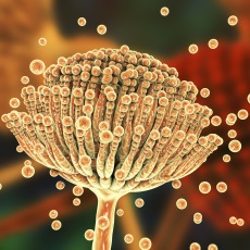 Aspergillosis
