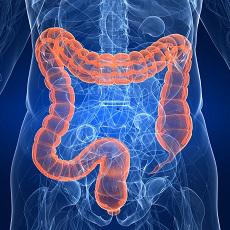 Colorectal Cancer