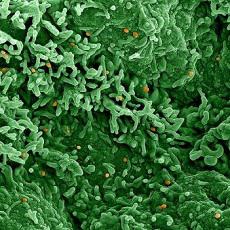 Monkeypox Virus Infections