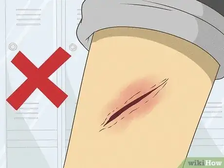 Image titled What Does It Mean when Your Cat Licks You Step 11