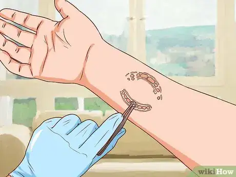 Image titled Treat a Human Bite Step 9