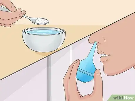 Image titled Drain Sinuses Step 4