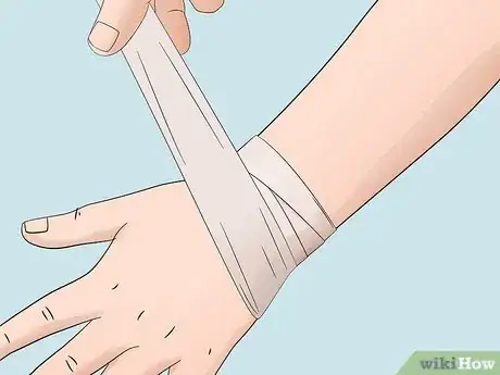 Image titled Treat Infected Insect Bites at Home Step 6