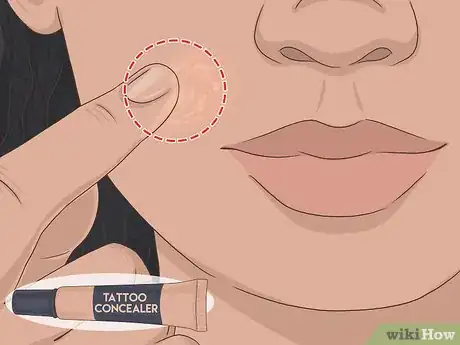 Image titled Cover a Mole Step 8