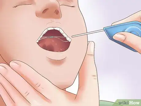 Image titled Deal With a Palate Expander Step 13