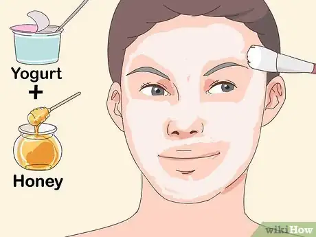 Image titled Treat Nodular Acne Step 10
