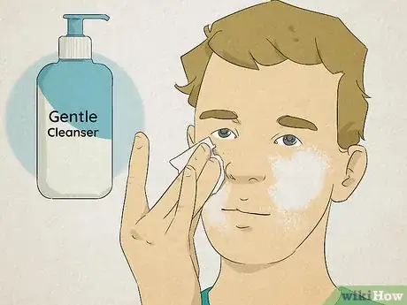 Image titled Get Rid of Wrinkles Naturally Step 1