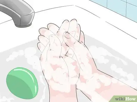 Image titled Treat Spider Bites on Kids Step 4